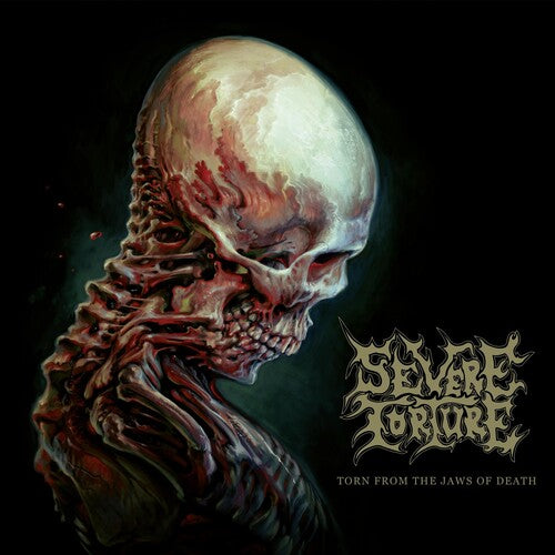 Severe Torture - Torn From The Jaws Of Death