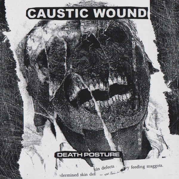 Caustic Wound ‎– Death Posture